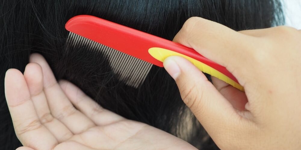 Waar kunnen luizen niet tegen? Tips Scheren.nl